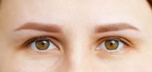 Microshading 2 après